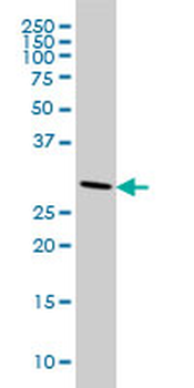 CNOT7 monoclonal antibody (M01A), clone 2F6