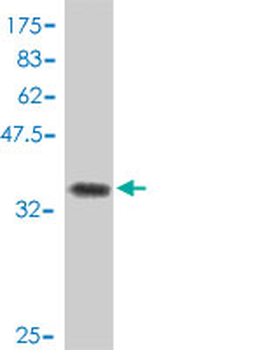 CNOT7 polyclonal antibody (A01)