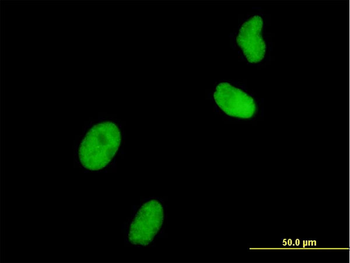 UHRF1 monoclonal antibody (M01), clone 3A11