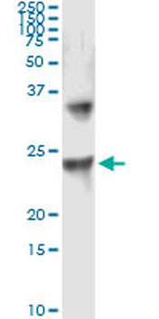 UBE2T monoclonal antibody (M01), clone 1E12-4A3