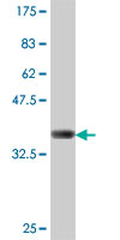 CDH19 polyclonal antibody (A01)