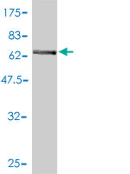 MAT2B polyclonal antibody (A01)