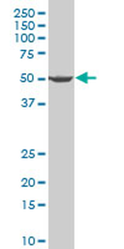 PRPF19 polyclonal antibody (A01)