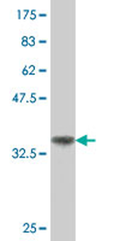 TEKT2 polyclonal antibody (A01)