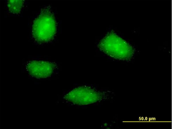 SESN1 purified MaxPab mouse polyclonal antibody (B01P)