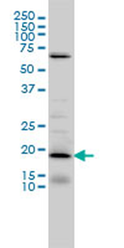 D4S234E monoclonal antibody (M01), clone 1C3