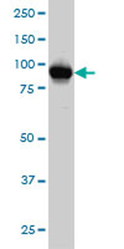 ATP2C1 monoclonal antibody (M01), clone 2G1