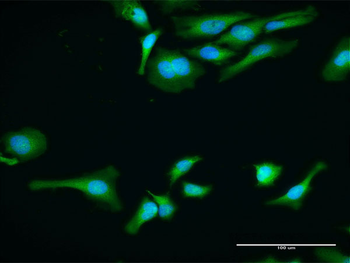 PABPC1 purified MaxPab rabbit polyclonal antibody (D01P)