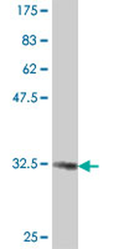 COPG2 polyclonal antibody (A01)