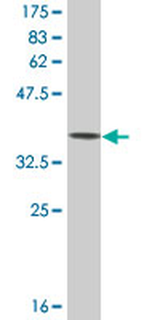 TIMM13 monoclonal antibody (M03A), clone 4F4