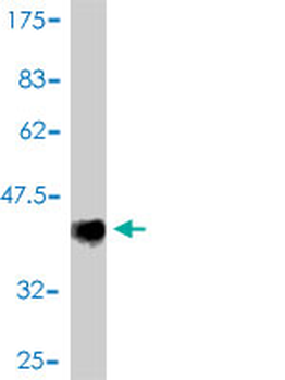 TIMM13 polyclonal antibody (A01)