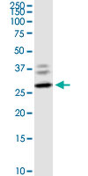 CLEC4E monoclonal antibody (M08), clone 2D12