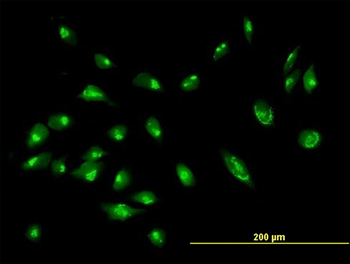 GORASP2 purified MaxPab mouse polyclonal antibody (B01P)