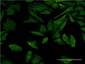 DFNB31 monoclonal antibody (M05), clone 2D12