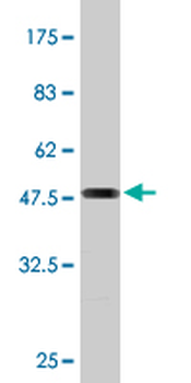 BRMS1 monoclonal antibody (M01), clone 2D4-2G11