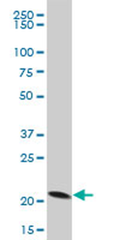 PRDX5 polyclonal antibody (A01)
