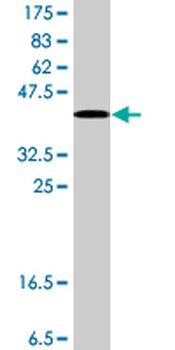 QPCT polyclonal antibody (A01)