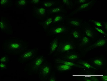 FBXO7 monoclonal antibody (M01), clone 4G8