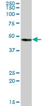 CA14 purified MaxPab mouse polyclonal antibody (B01P)