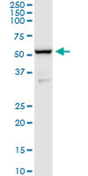 BACE1 monoclonal antibody (M01), clone 2C1