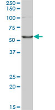 CORO1C monoclonal antibody (M02), clone 1F7