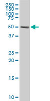 CORO1C polyclonal antibody (A01)
