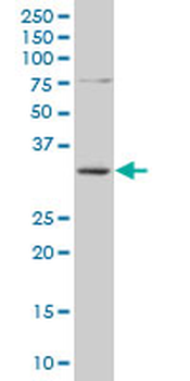 SMUG1 polyclonal antibody (A01)