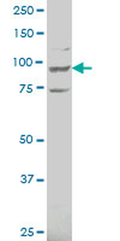 ATP6V0A2 polyclonal antibody (A01)