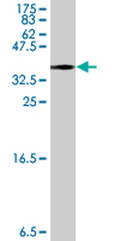 MACF1 polyclonal antibody (A01)