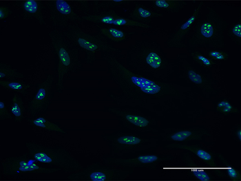 PES1 MaxPab mouse polyclonal antibody (B02)