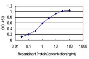QPRT monoclonal antibody (M01), clone 5D11
