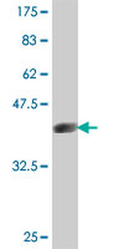 QPRT polyclonal antibody (A01)