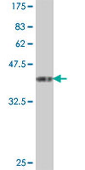 SLC44A1 polyclonal antibody (A01)