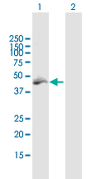 MLYCD purified MaxPab mouse polyclonal antibody (B01P)