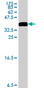 SYNE2 polyclonal antibody (A01)