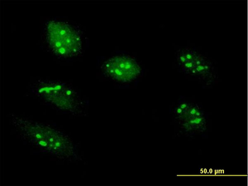 RRS1 purified MaxPab mouse polyclonal antibody (B02P)