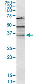 NMNAT2 monoclonal antibody (M02), clone 4E6