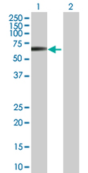 STK38L purified MaxPab mouse polyclonal antibody (B01P)