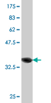 RAB21 monoclonal antibody (M03), clone 1G4
