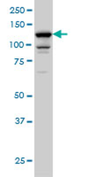 DAAM1 monoclonal antibody (M05), clone 5D3