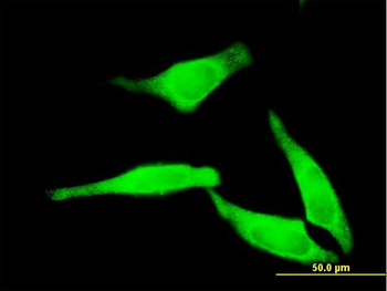NT5C2 monoclonal antibody (M02), clone 3C1