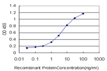 TRIM32 monoclonal antibody (M09), clone 2E5