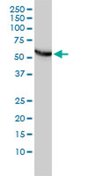 CCT5 monoclonal antibody (M01), clone 4E5-4B1