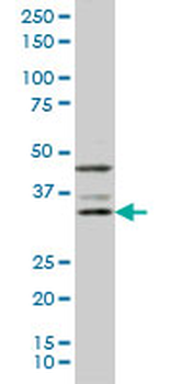 DKK1 monoclonal antibody (M01), clone 4D4