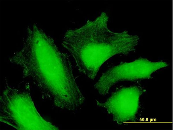 MTMR15 purified MaxPab mouse polyclonal antibody (B01P)