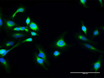 SACM1L purified MaxPab rabbit polyclonal antibody (D01P)