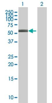 ABLIM3 MaxPab mouse polyclonal antibody (B01)