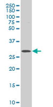 ICK polyclonal antibody (A01)