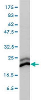 CBX3 monoclonal antibody (M01), clone 1G12-1D9