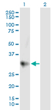 CTRC purified MaxPab mouse polyclonal antibody (B01P)